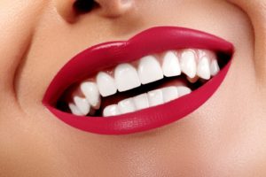 Close-up of woman’s beautiful smile with veneers in Trumbull